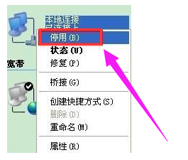 本地連接